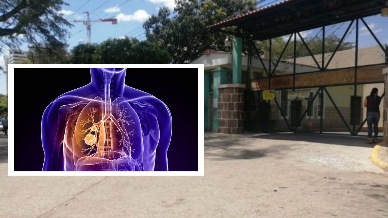 Día Mundial contra el Cáncer de Pulmón: ¿fuma?, vea cómo puede prevenir la enfermedad