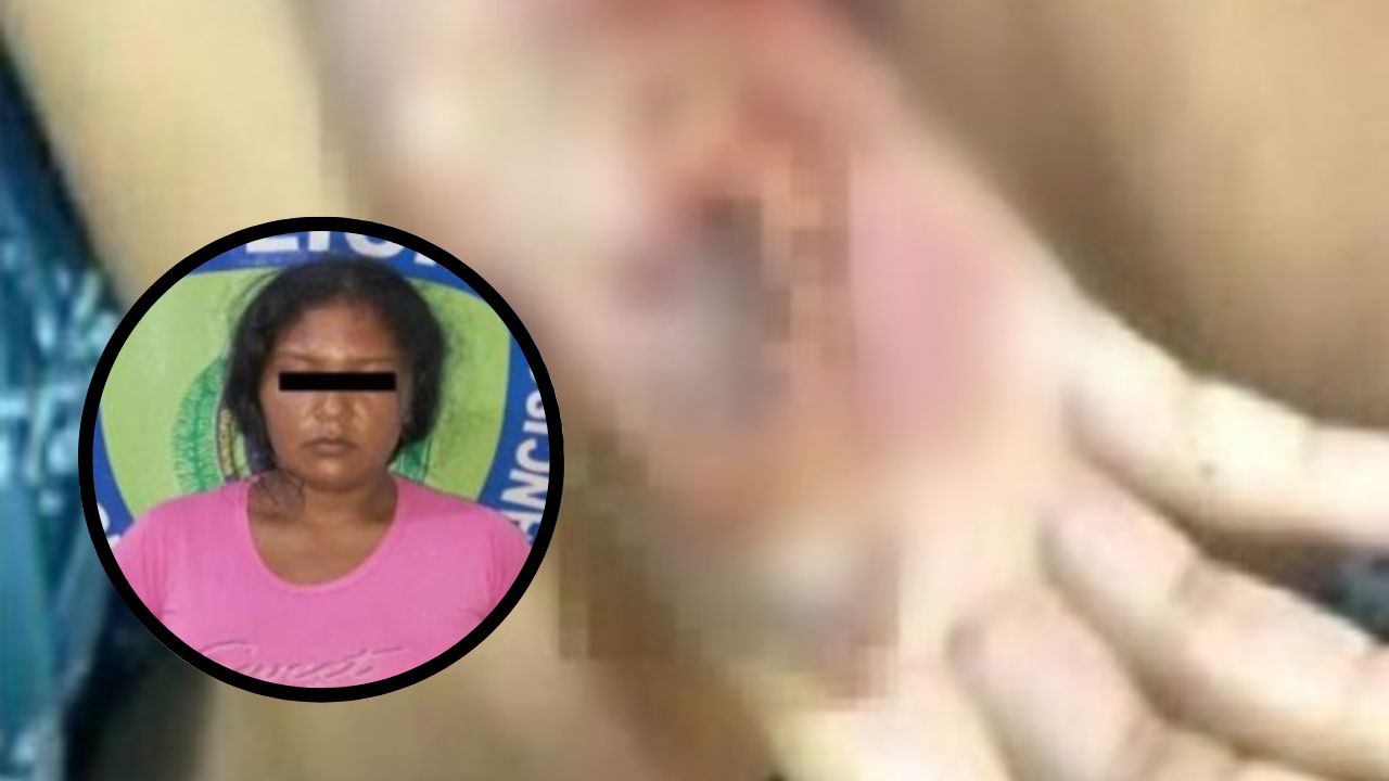 Madre quema las manos de su hija 'como castigo' y la obligaba a solo verla comer