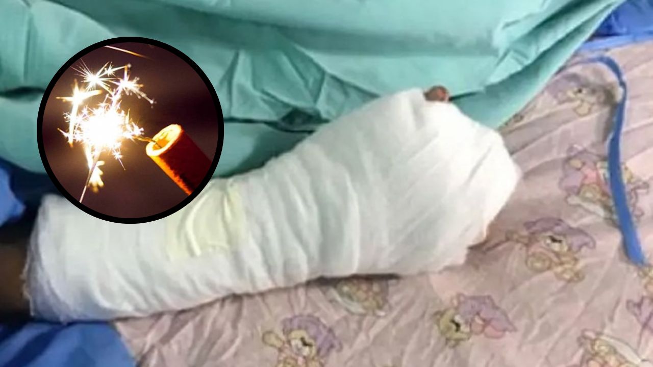 Anuncian sanciones para padres de niños que resulten quemados por pólvora en Navidad