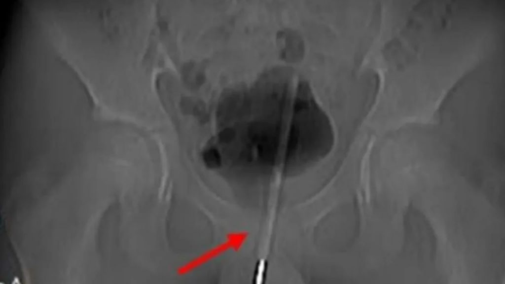 Imagen de cuerpo de nota