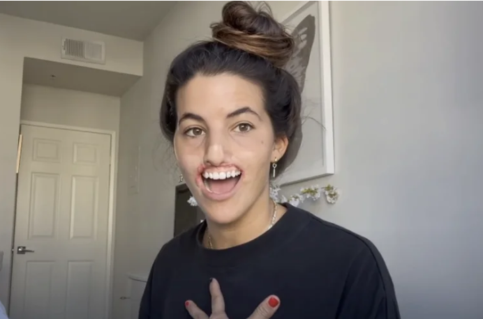 Imagen de cuerpo de nota