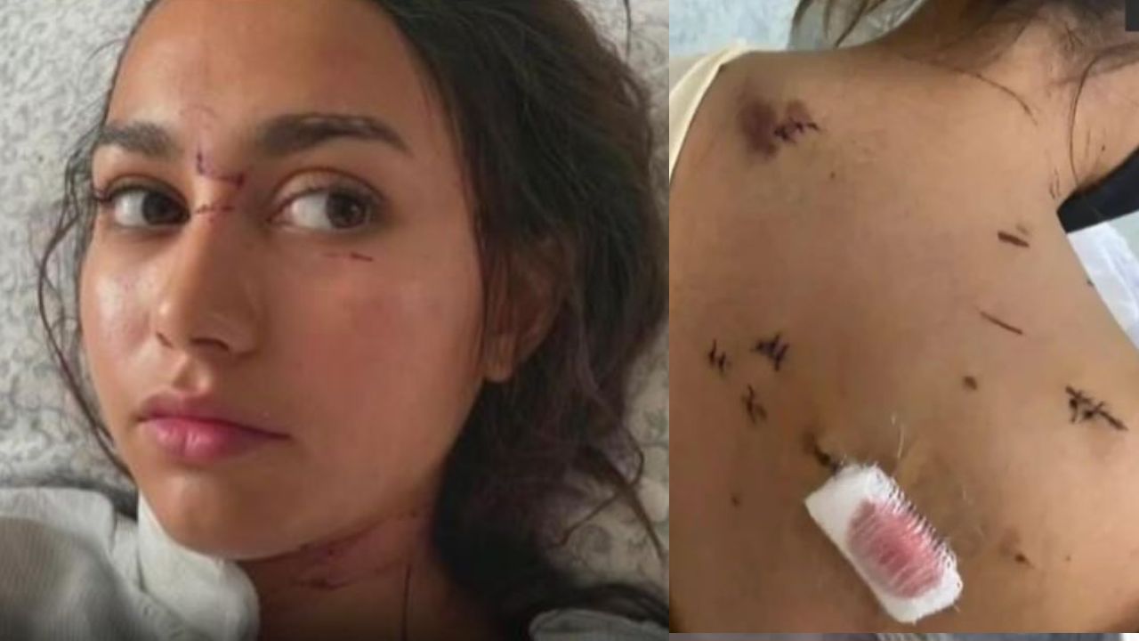 'Recibí 47 puñaladas', joven de 17 relata cómo su ex la atacó en un intento por matarla