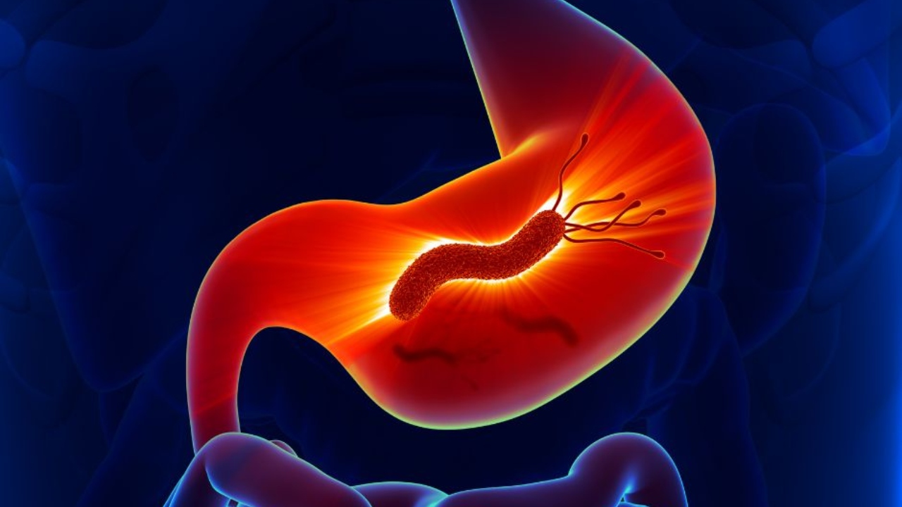 Porque Nos Importa: el 80 por ciento de hondureños porta Helicobacter pylori