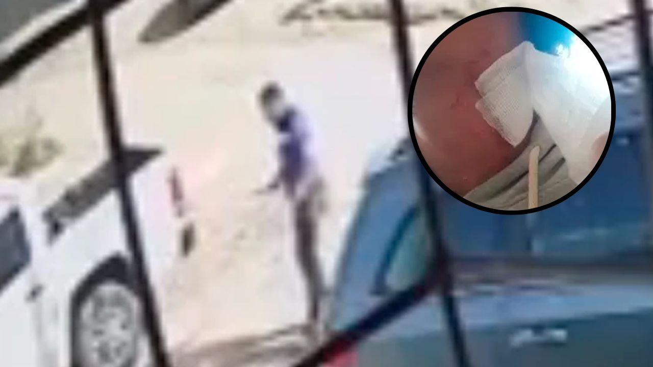 Hombre apuñala y mata a un pitbull que mordió el cuello de su hijo