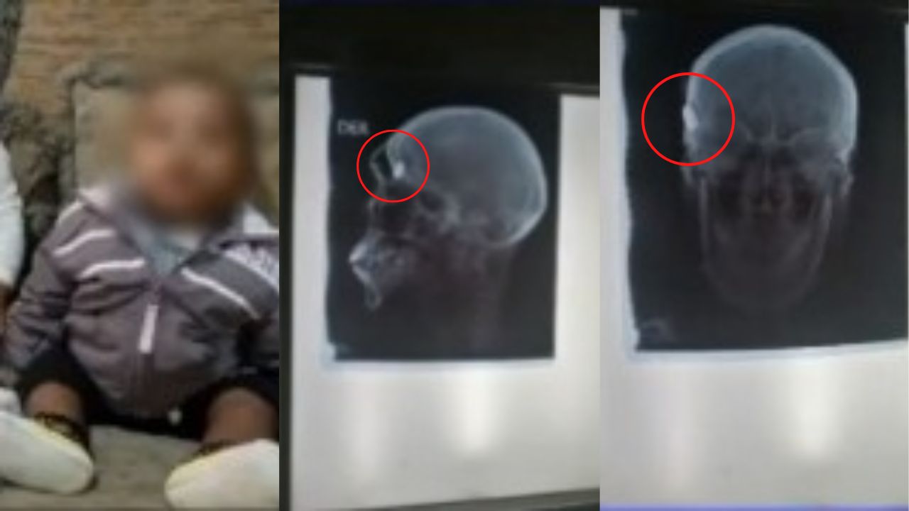 Un menor de 7 meses muerto y un joven de 14 años resulta herido en tiroteo en La Ceiba