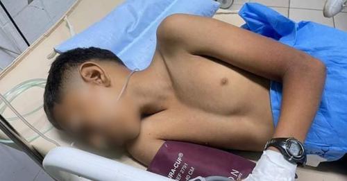 Entre la vida y muerte, niño hondureño golpeado por compañero de escuela