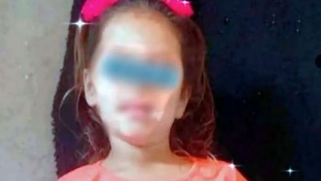 Imagen de Niña se fracturó el cráneo durante el cumpleaños de su hermanito