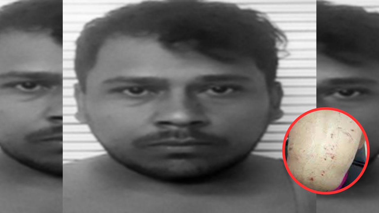 Hombre golpeó salvajemente a su sobrina de 6 años por tomar comida sin permiso