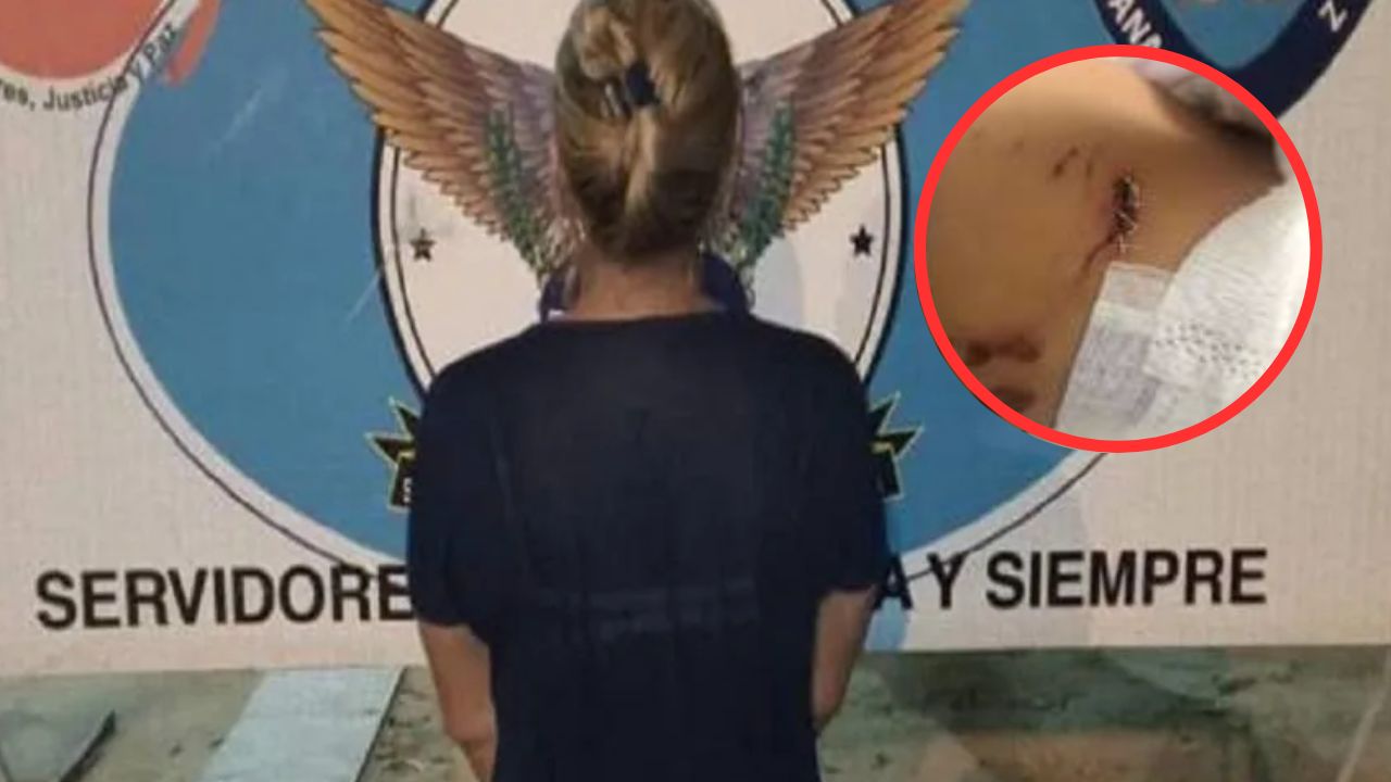 Madre muerde brutalmente el brazo de su hijo en medio de pelea familiar