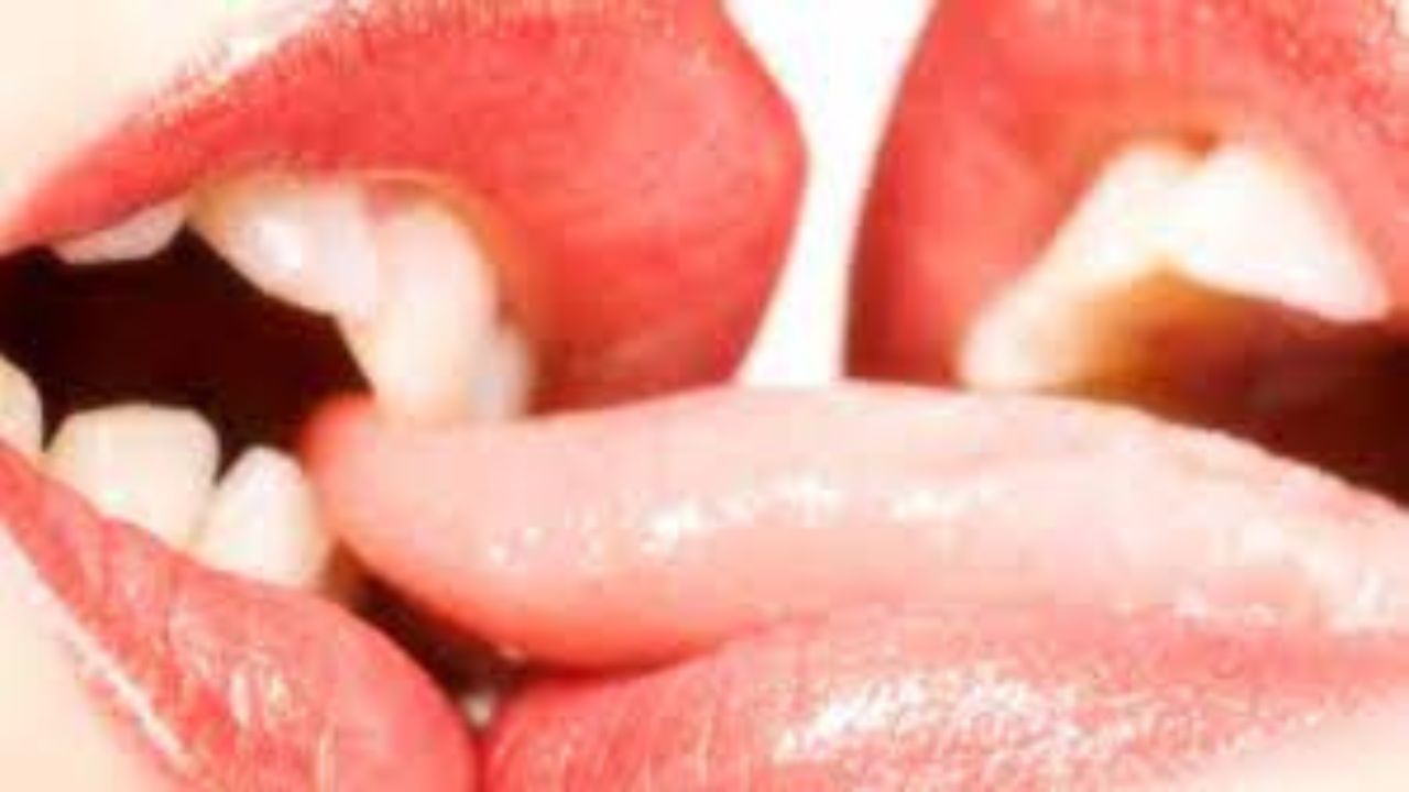 Mujer arrancó pedazo de la lengua al hombre que intentó violarla