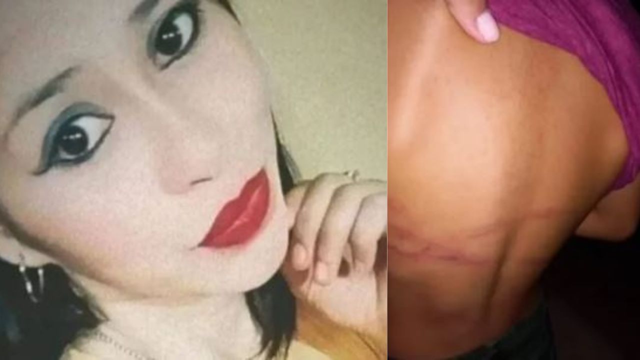 'A veces hay que corregirlo', dice madre acusada de golpear los genitales de su pequeño hijo