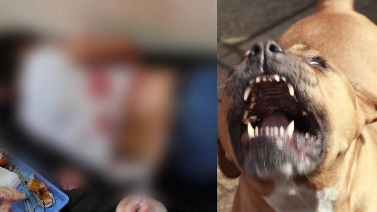 Pitbull ataca a niño en Copán; 'estaba jugando con el perro del vecino'