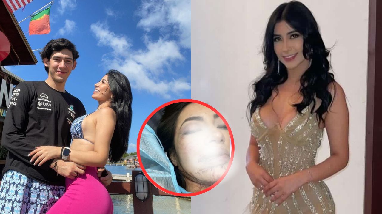 'Retrocedió y la aplastó': Así fue el brutal ataque de hondureño a su novia