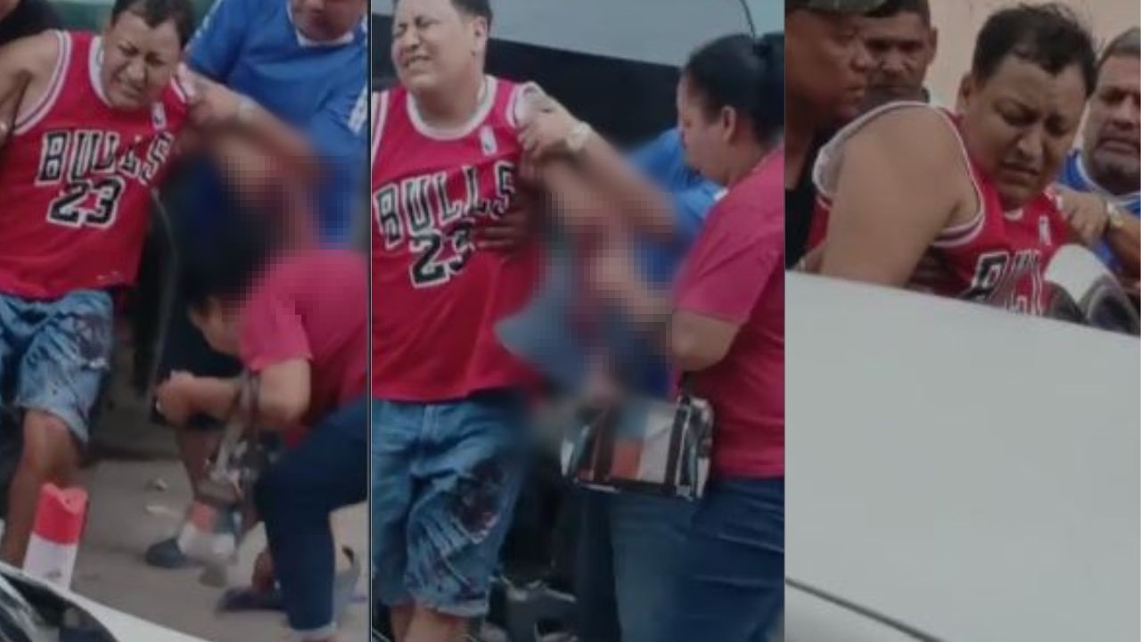 Impactante vídeo de hondureño con su brazo destrozado en accidente de moto
