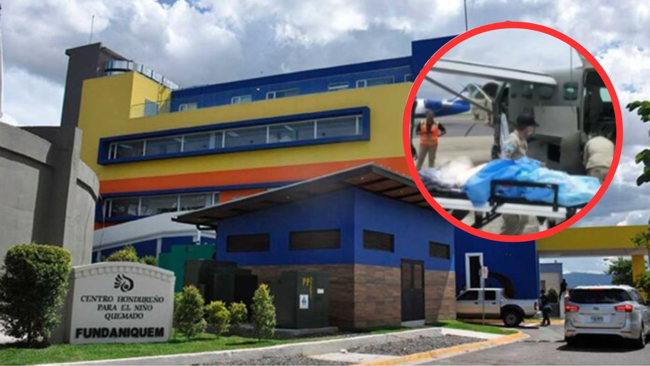 Fallece adolescente que sufrió graves quemaduras en Roatán cuando cocinaba en el Día del Padre