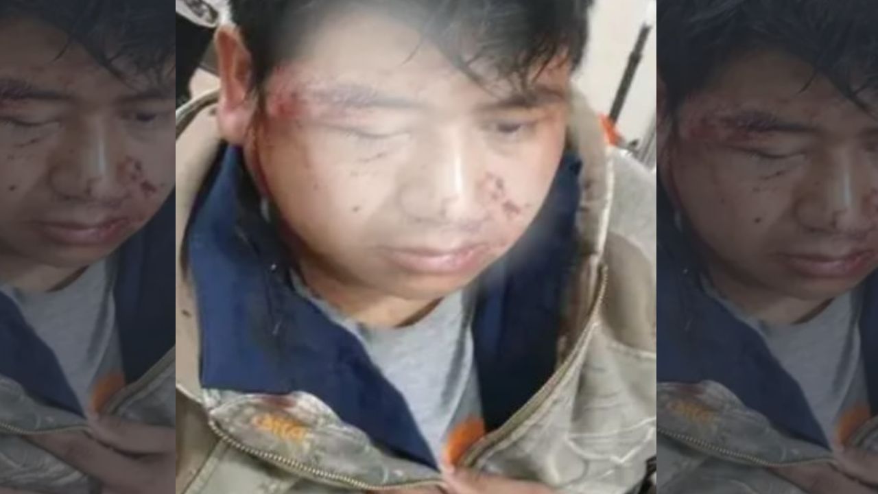 Entre la vida y la muerte, migrante hondureño que cayó de un segundo piso en EE. UU.