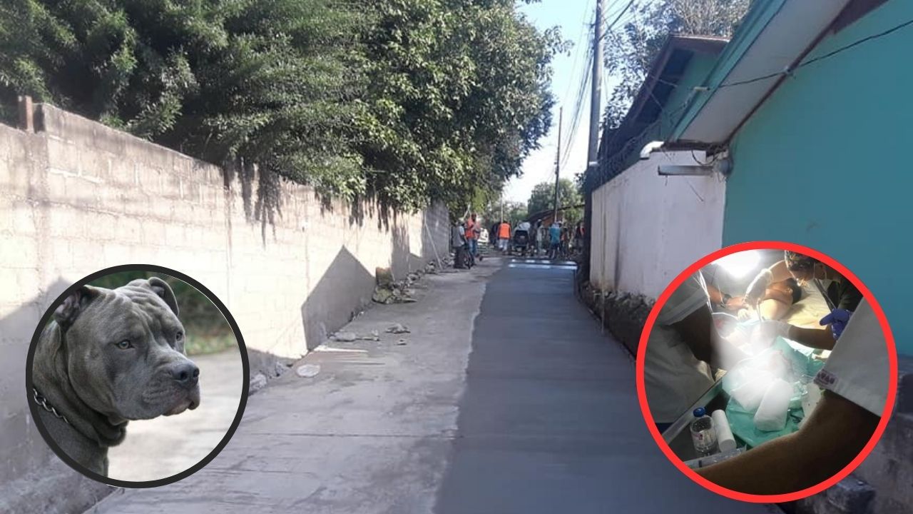 Madre e hijo fueron atacados por un perro pitbull en Yoro; el menor terminó con su pierna destrozada