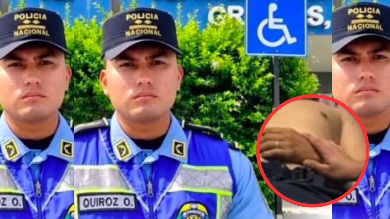 Entre la vida y la muerte policía herido en enfrentamiento con criminales en Gracias, Lempira