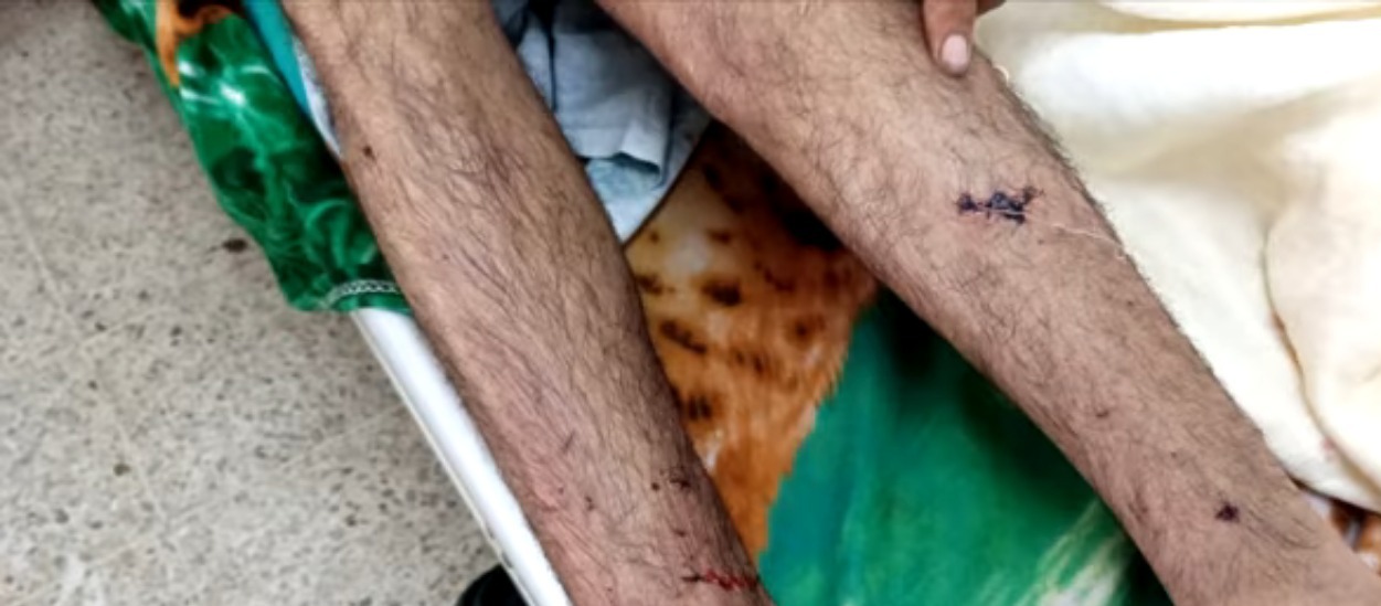 Imagen de cuerpo de nota