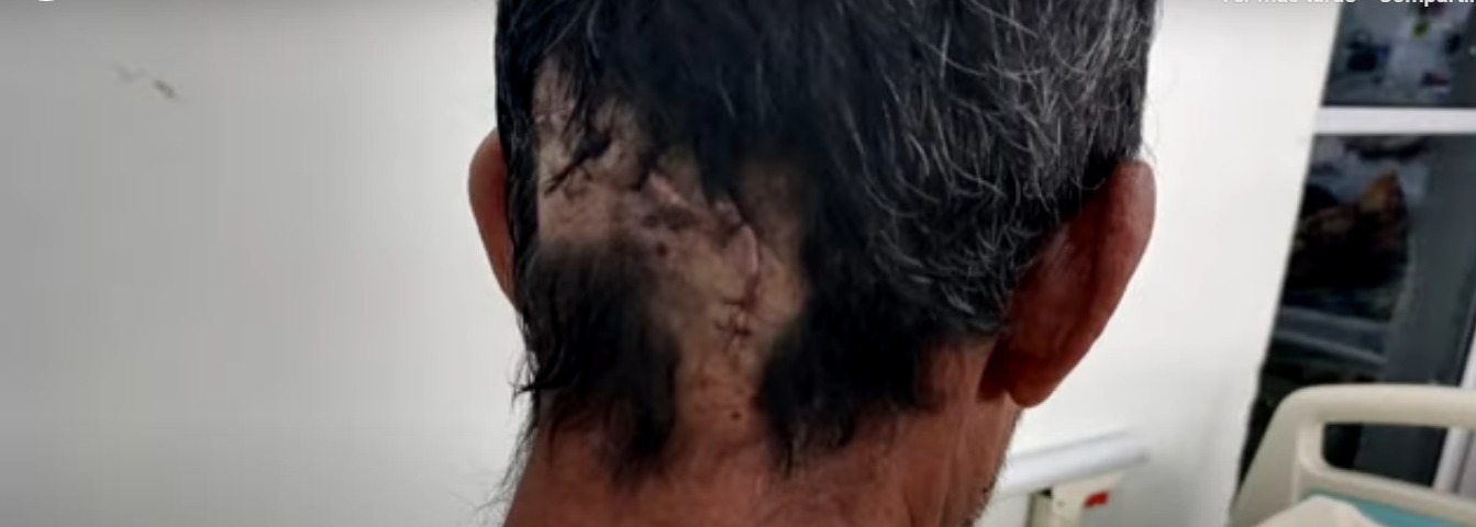 Imagen de cuerpo de nota