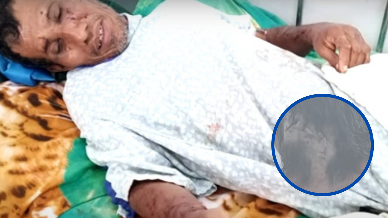 Perros pitbull atacan a hombre en Choluteca; familiares piden sacrificar a los animales