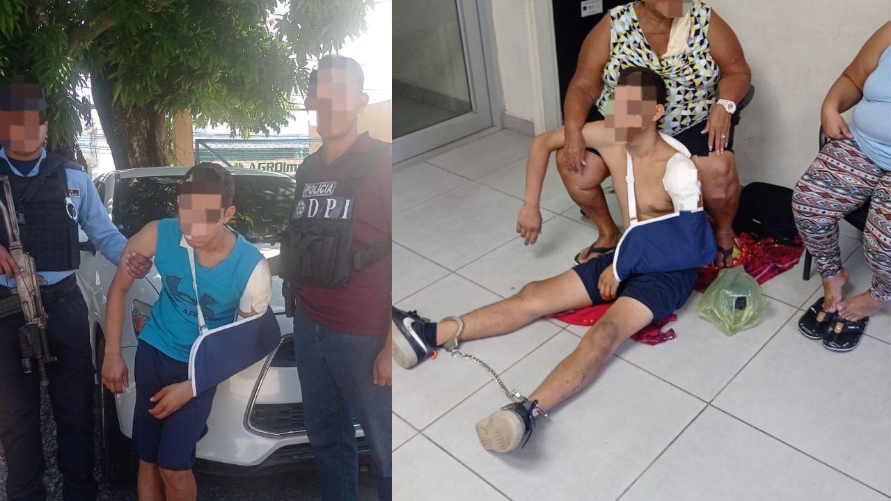 Con un 'brazo quebrado', así llegó a audiencia pandillero que chocó contra un árbol intentando huir