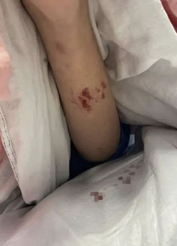 Imagen de cuerpo de nota