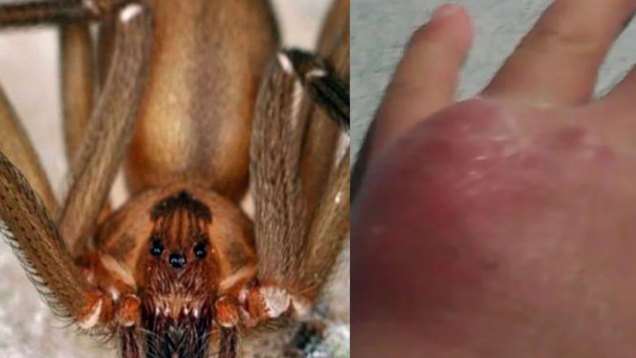 Tarántula en medio de cobijas picó a un niño de 6 años cuando estaba jugando en su cama