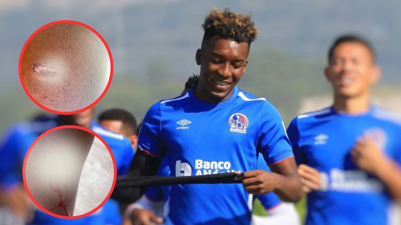 Exjugador del Olimpia revela la verdad sobre supuesto ataque en discoteca de SPS
