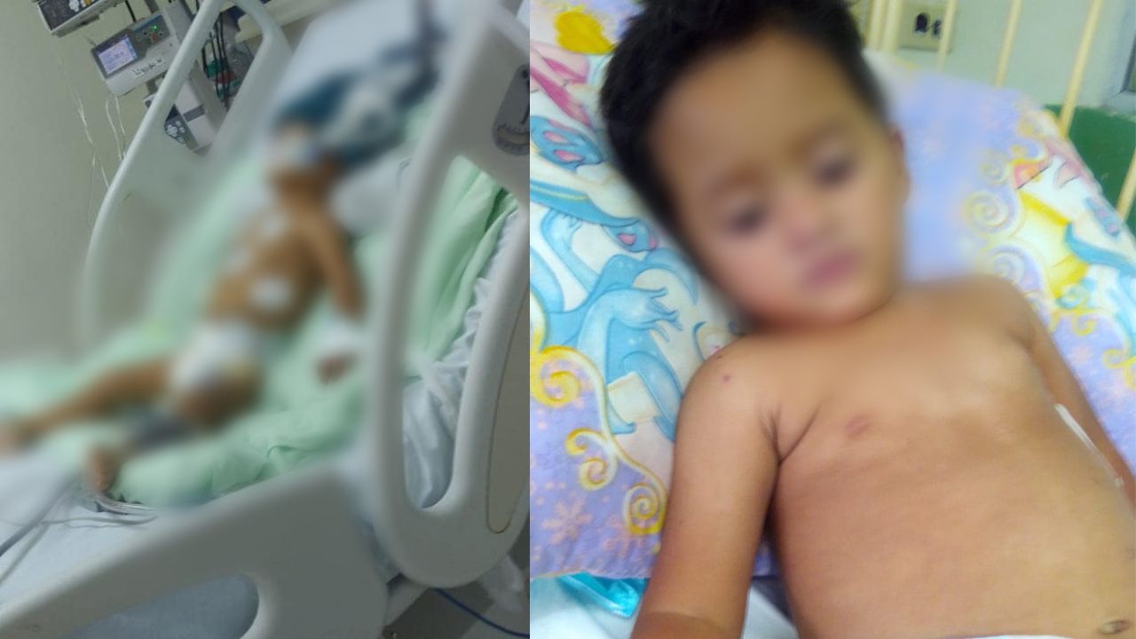 Niño hondureño sobrevive de milagro: un carro le pasó por encima y le dejó 9 fracturas