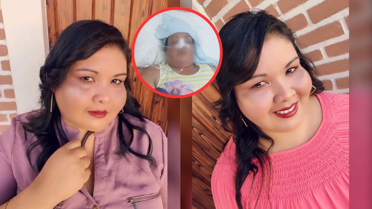 ¿Mala praxis? Murió hondureña que estuvo en coma por sacarse una muela