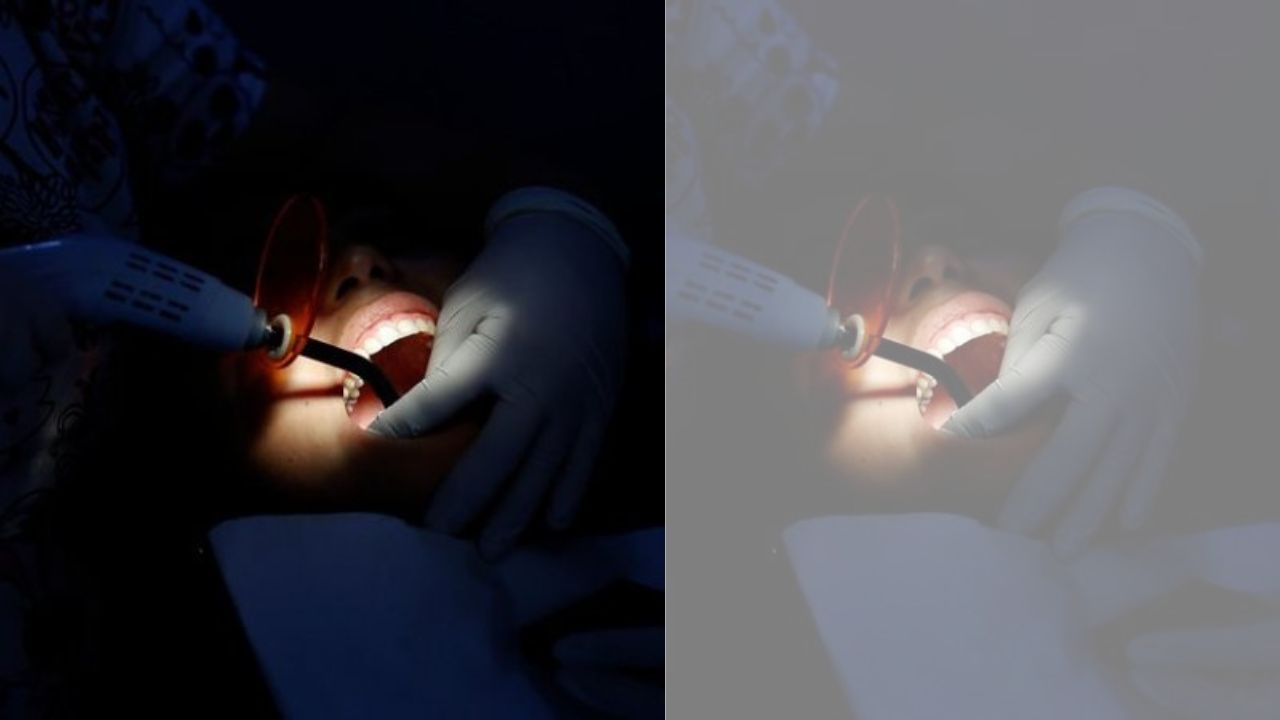 Imagen de 'No se podía mover', joven fue al médico por dolor de muela: lo inyectaron y murió