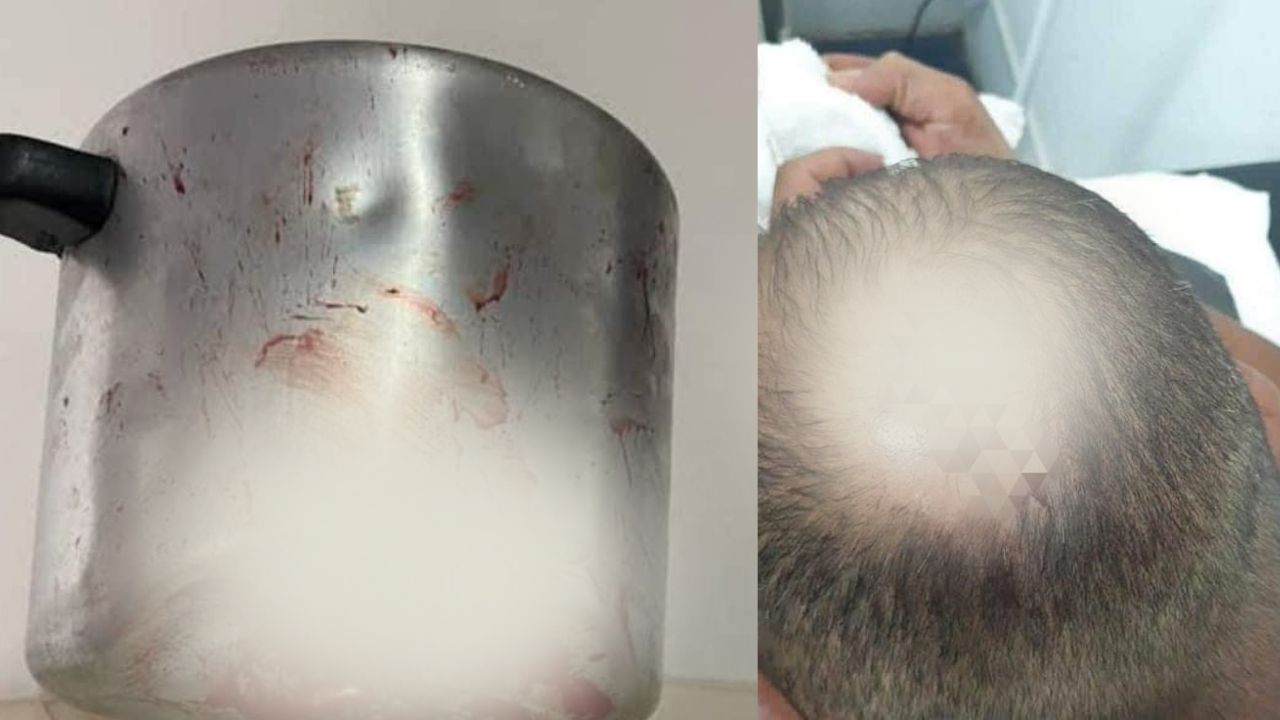 Imagen de Mujer celosa golpeó con una olla de presión a su esposo porque dejó el celular desbloqueado