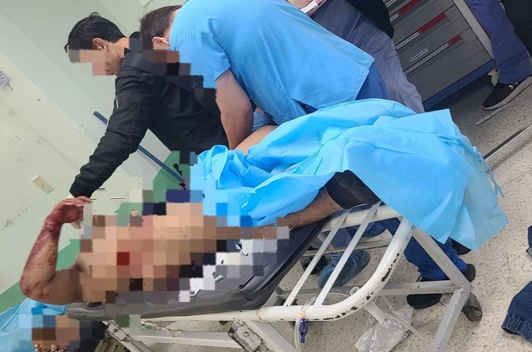 El presunto miembro de la Pandilla 18 resultó herido tras el enfrentamiento armado. Foto: HRN