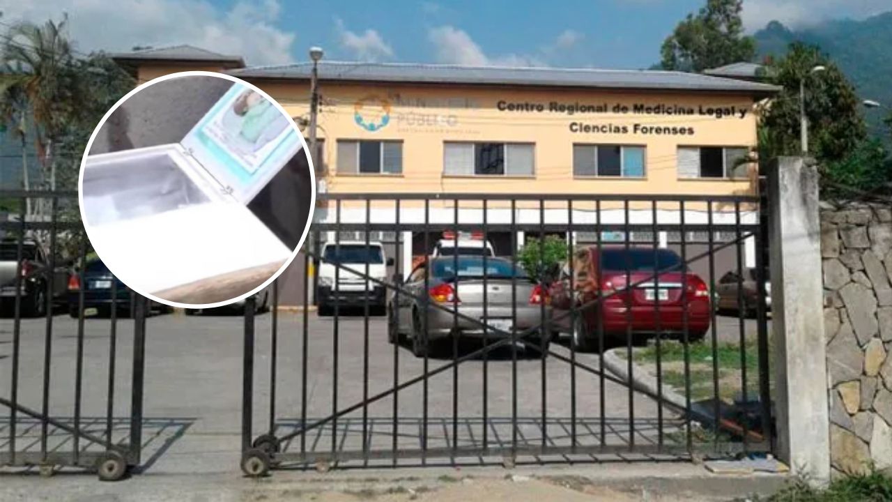 Medicina Forense confirma que niña de un año bajo cuidado de la Dinaf falleció por desnutrición