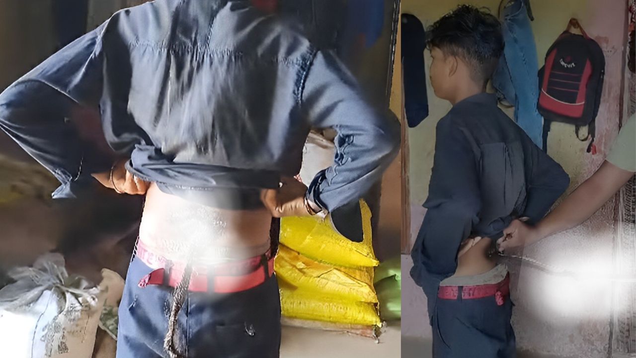 Joven es considerado un dios por tener una cola hecha de pelos