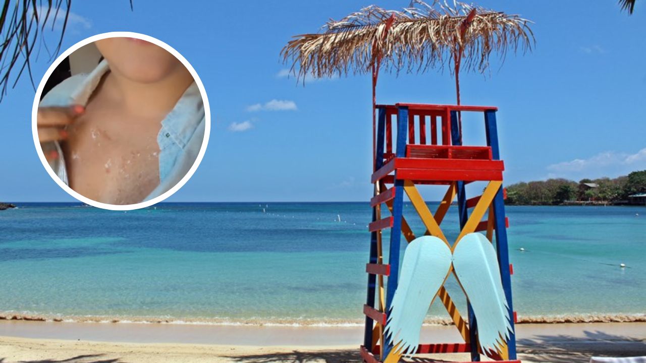 Imagen de Hondureña relata el trágico momento que vivió con su hijo cuando los picó una medusa en Roatán