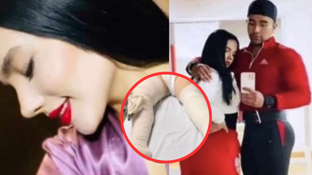 Joven sobrevive de milagro tras ser arrojada desde un tercer piso por su novio 'celoso'