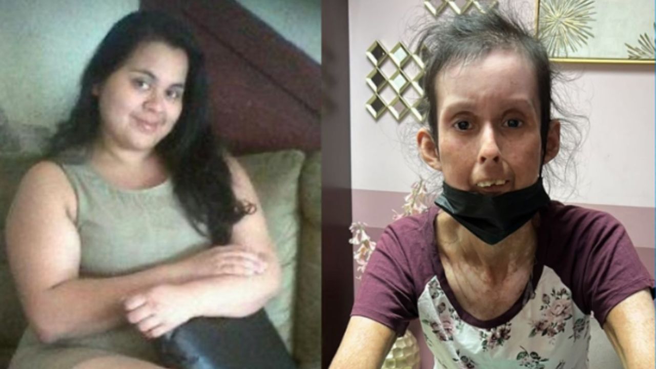 Antes y después de Francia Hernández. Foto: Cortesía