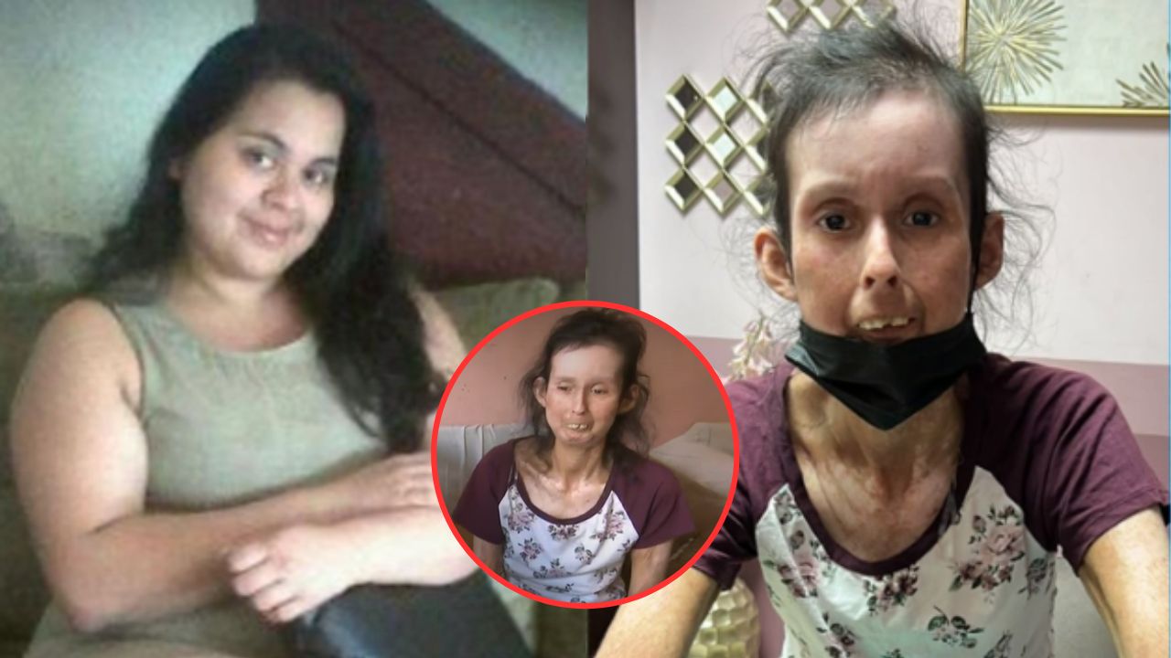 'Tengo miedo de morir': la emotiva historia de una hondureña que sufre una rara enfermedad