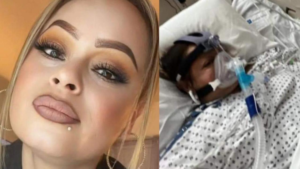 Imagen de Lo que se sabe de la bacteria 'Vibrio Vulnificus' por la cual mujer terminó amputada de manos y pies