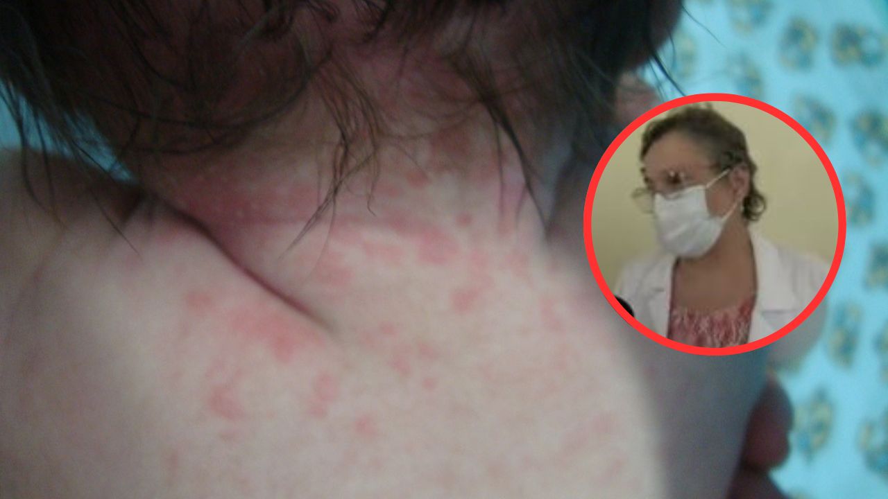 Imagen de ¿Qué es la sífilis neonatal? Conoce las consecuencias de esta enfermedad