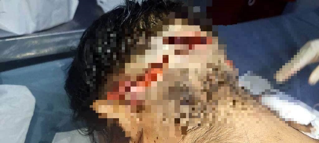 Imagen de cuerpo de nota