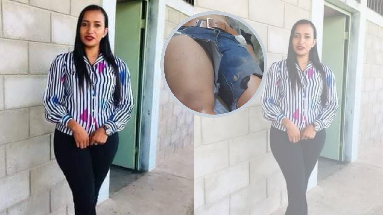 Universitaria hondureña, entre la vida y muerte tras accidente en moto; buscan recaudar fondos