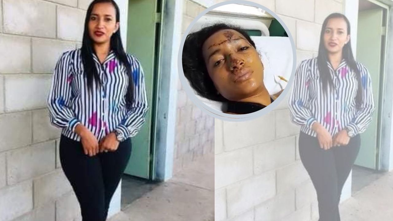Universitaria hondureña sufre accidente en moto y desde su lecho de enferma envía mensaje