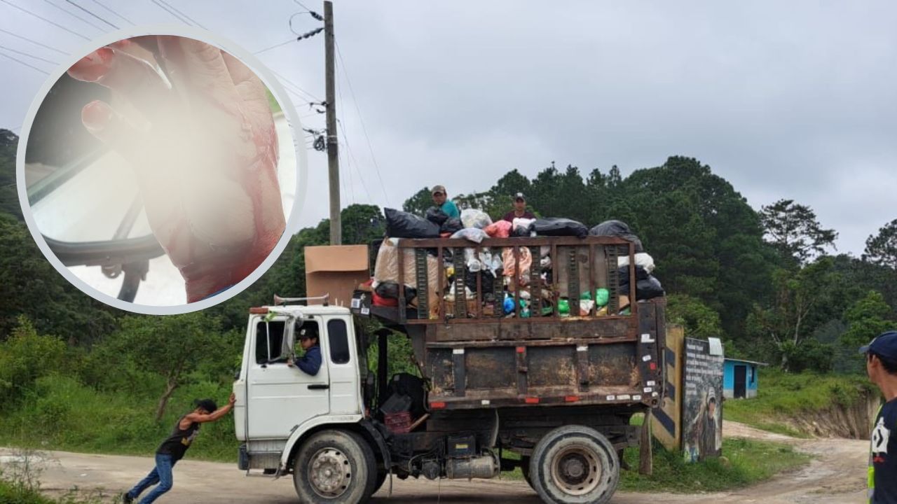 Recolector de basura en Honduras muestra su mano con sangre por vidrios y objetos cortopuzantes