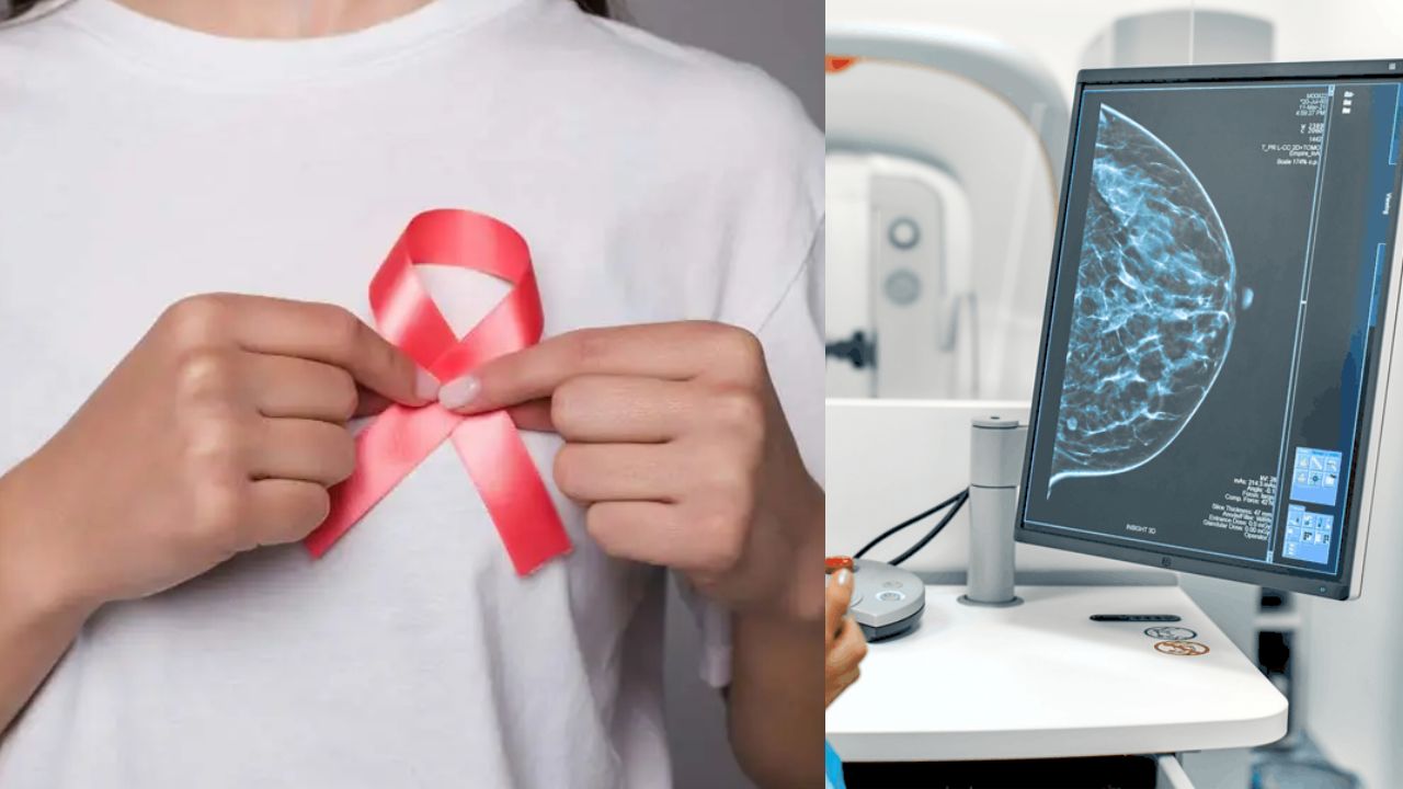 IA permitirá avanzar hacia un tratamiento menos invasivo del cáncer de mama