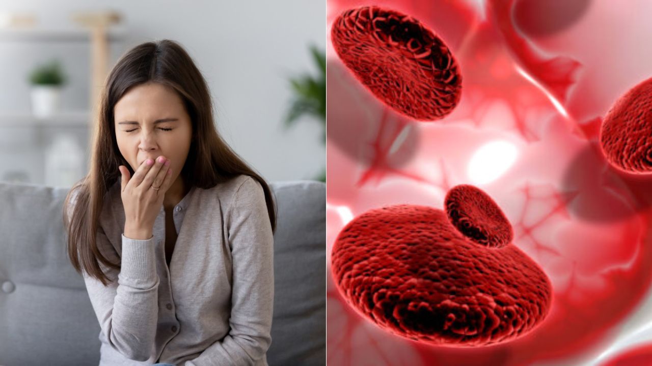 Imagen de Cómo saber si tienes deficiencia de hierro y qué hacer al respecto