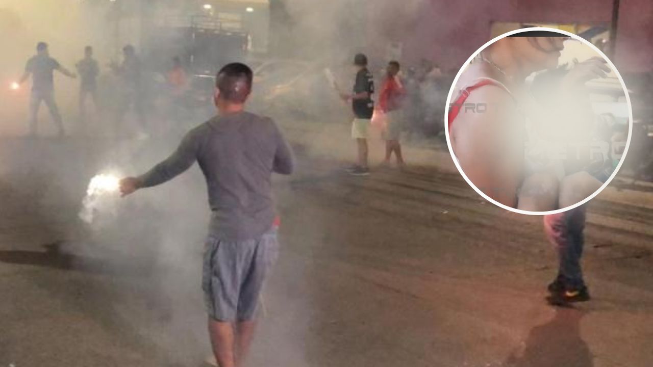 Niño de 6 años salió de su casa a jugar a la calle y un mortero le explotó en el rostro en Choluteca