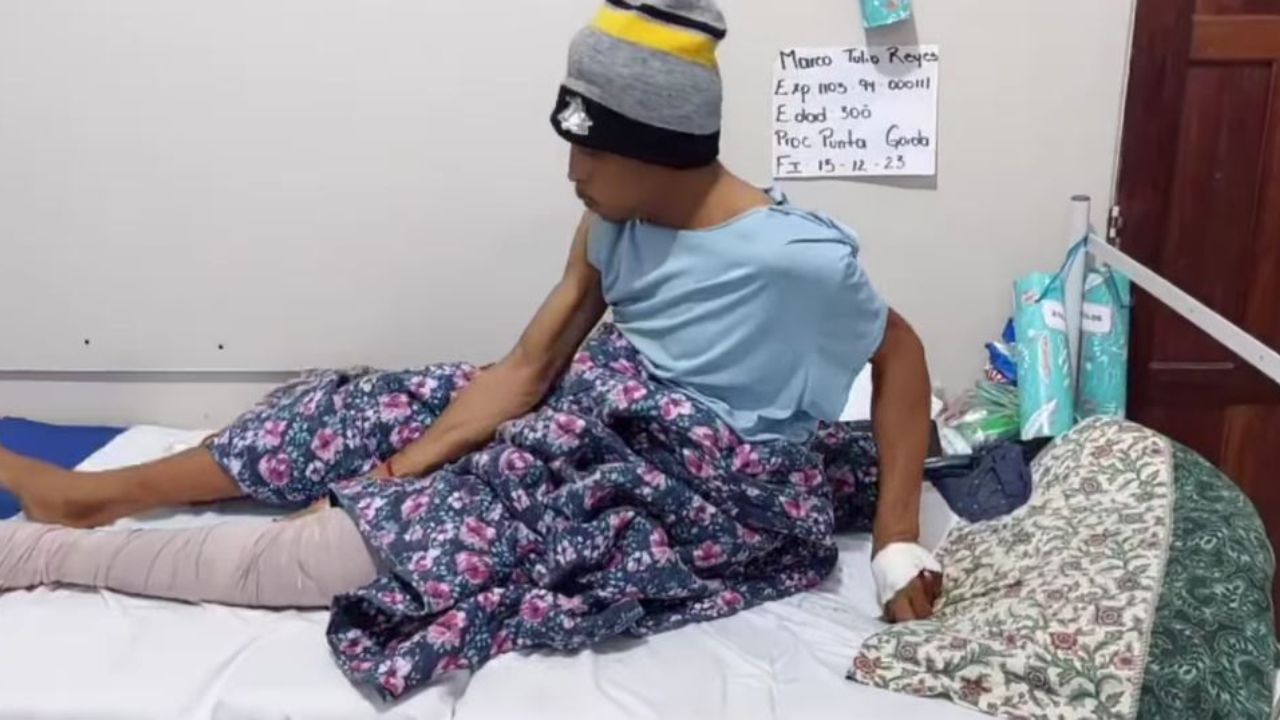 Imagen de Con su pie fracturado terminó hondureño por reclamarle a su cuñado por enamorar a su pareja